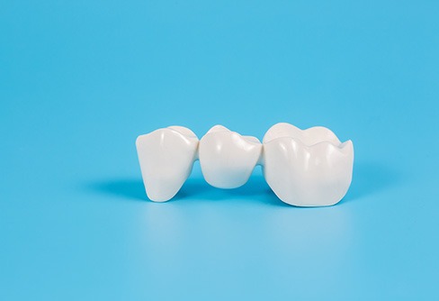 Picture of a dental bridge on a slightly reflective light blue surface