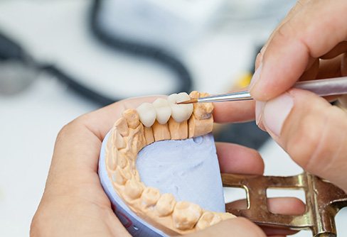 Technician building dental bridge on model teeth