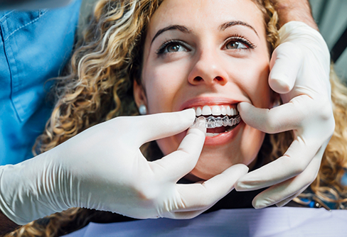 Dentist placing a clear aligner over a patients teeth