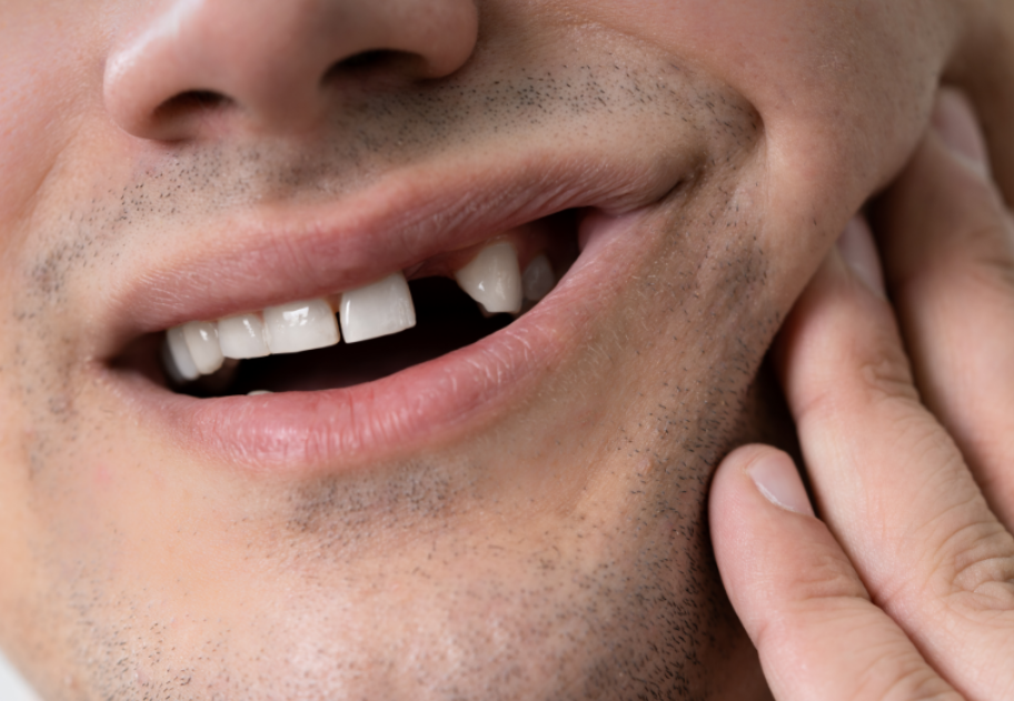 Man missing tooth
